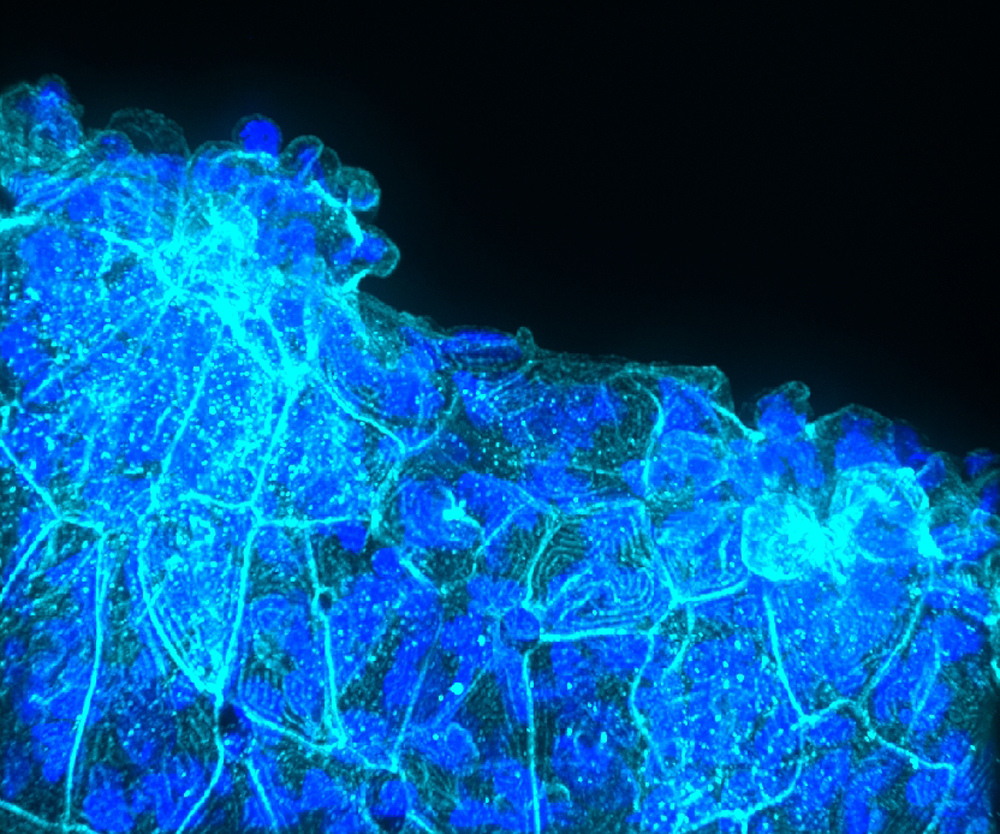 Cell masses accumulate in epidermis of a by eLife - the journal, on Flickr