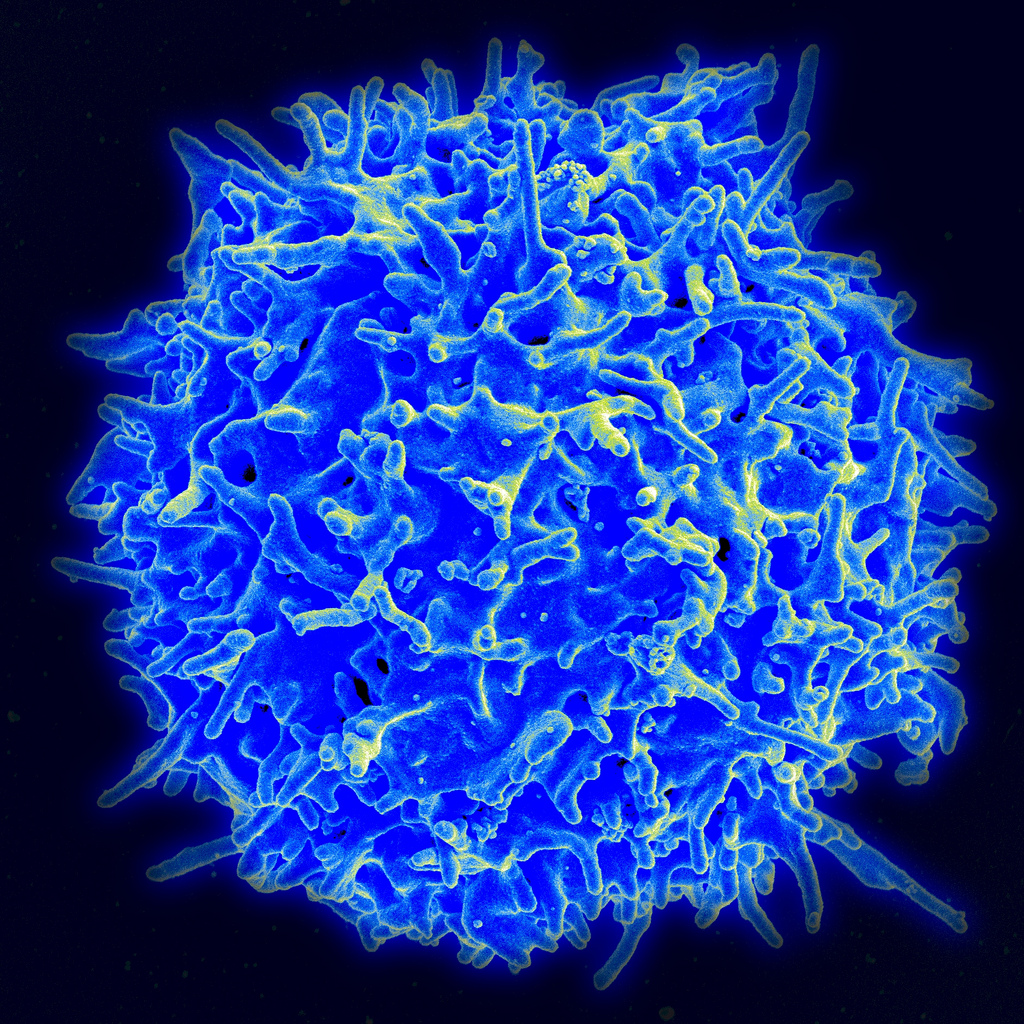 Healthy Human T Cell by NIAID, on Flickr
